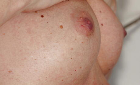 Foxy hungarian aged Laura Oswald exposing tiny tits and shaved pussy 